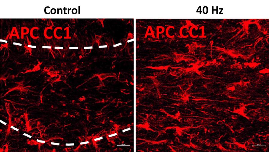 Sensory Stimulation Preserves Brain's White Matter